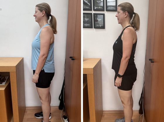 Before and after, side view: a flatter stomach and stronger posture in nine weeks
